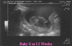 Baby G 12 week scan no 1